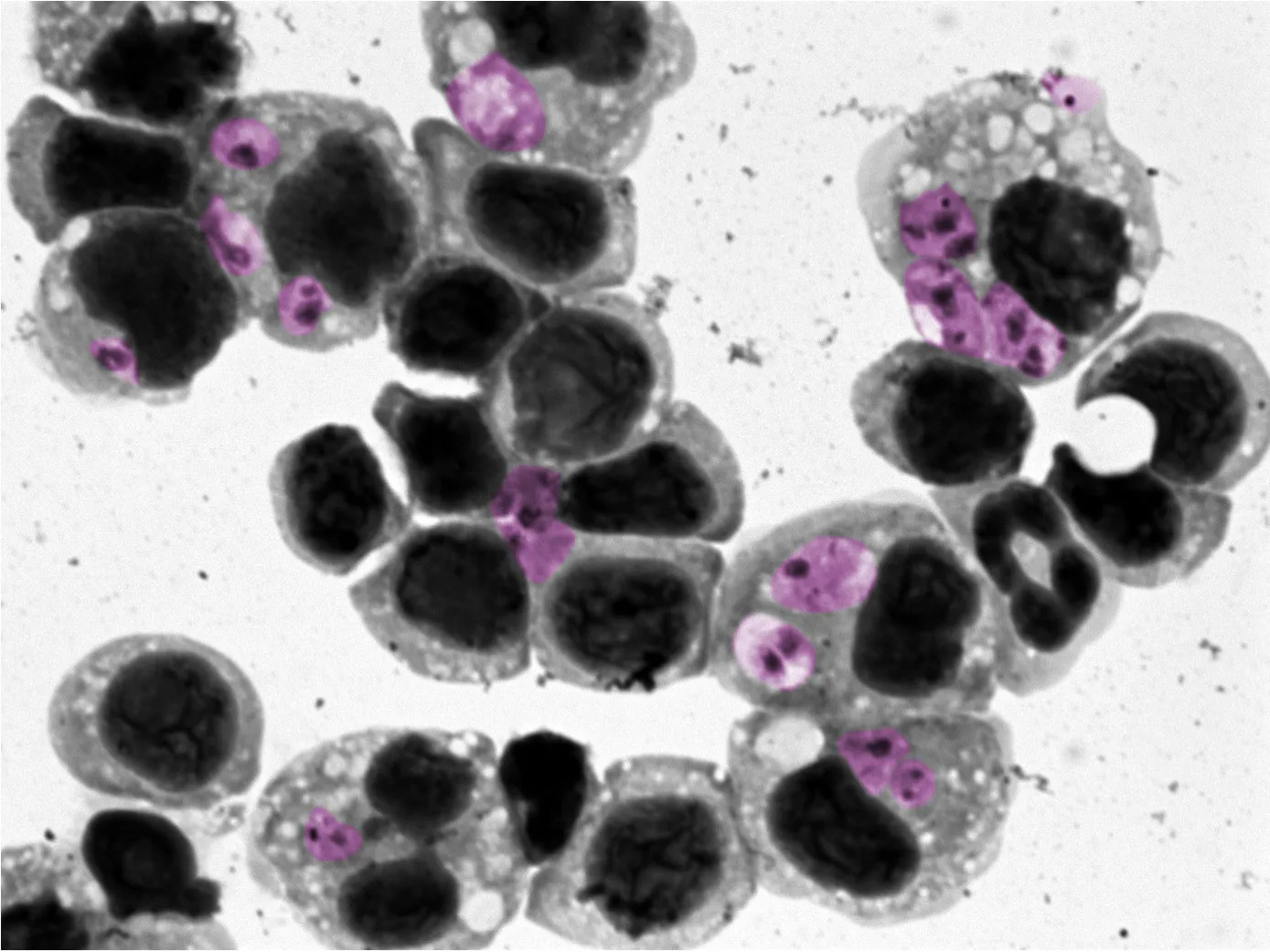 close-up of leishmaniasis